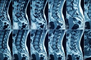 Can a PT Order an MRI? Requirements & Process Safem Fabrication - Precision Engineering & Custom Manufacturing Solutions Can a PT Order an MRI? Requirements & Process | Safem Fabrication - Precision Engineering & Custom Manufacturing Solutions