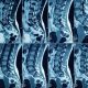 Can a Physical Therapist Order an MRI Scan? | Physical Health & Fitness – Boost Your Body, Energy, and Wellbeing