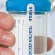 Does a DOT Physical Include a Drug Test? | Physical Health & Fitness – Boost Your Body, Energy, and Wellbeing