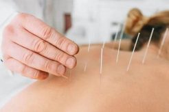 Dry Needling Physical Therapy Near Me Physical Health & Fitness – Boost Your Body, Energy, and Wellbeing Dry Needling Physical Therapy Near Me | Physical Health & Fitness – Boost Your Body, Energy, and Wellbeing