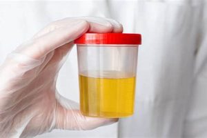 DOT Physical Urine Sample: A Complete Guide Physical Health & Fitness – Boost Your Body, Energy, and Wellbeing DOT Physical Urine Sample: A Complete Guide | Physical Health & Fitness – Boost Your Body, Energy, and Wellbeing