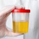 DOT Physical Urine Sample: A Complete Guide | Physical Health & Fitness – Boost Your Body, Energy, and Wellbeing