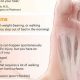 Best Plantar Fasciitis Physical Therapy Near Me | Physical Health & Fitness – Boost Your Body, Energy, and Wellbeing