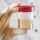 Synthetic Urine & DOT Physicals: Detection Methods | Physical Health & Fitness – Boost Your Body, Energy, and Wellbeing