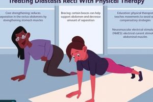 Best Diastasis Recti Physical Therapy Near Me Physical Health & Fitness – Boost Your Body, Energy, and Wellbeing Best Diastasis Recti Physical Therapy Near Me | Physical Health & Fitness – Boost Your Body, Energy, and Wellbeing