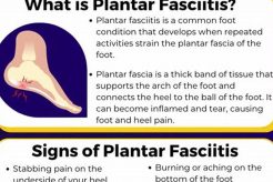 Top Plantar Fasciitis PTs Near You Physical Health & Fitness – Boost Your Body, Energy, and Wellbeing Top Plantar Fasciitis PTs Near You | Physical Health & Fitness – Boost Your Body, Energy, and Wellbeing