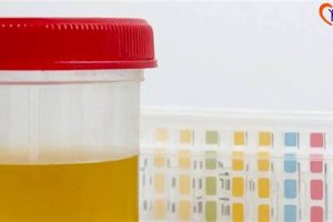 DOT Physical Urine Test: What to Expect & Why Physical Health & Fitness – Boost Your Body, Energy, and Wellbeing DOT Physical Urine Test: What to Expect & Why | Physical Health & Fitness – Boost Your Body, Energy, and Wellbeing