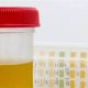 DOT Physical Urine Test: What to Expect & Why | Physical Health & Fitness – Boost Your Body, Energy, and Wellbeing