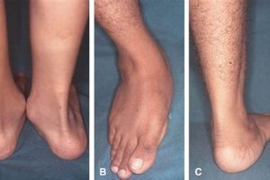 Understanding Physical Deformities & Treatments Physical Health & Fitness – Boost Your Body, Energy, and Wellbeing Understanding Physical Deformities & Treatments | Physical Health & Fitness – Boost Your Body, Energy, and Wellbeing