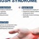 Effective Physical Therapy for Double Crush Syndrome Relief | Physical Health & Fitness – Boost Your Body, Energy, and Wellbeing
