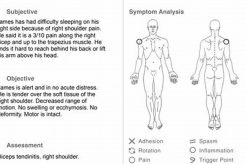 Complete SOAP Note Example for Physical Therapy Physical Health & Fitness – Boost Your Body, Energy, and Wellbeing Complete SOAP Note Example for Physical Therapy | Physical Health & Fitness – Boost Your Body, Energy, and Wellbeing