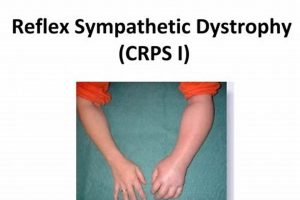 Best Reflex Sympathetic Dystrophy Physical Therapy Guide Physical Health & Fitness – Boost Your Body, Energy, and Wellbeing Best Reflex Sympathetic Dystrophy Physical Therapy Guide | Physical Health & Fitness – Boost Your Body, Energy, and Wellbeing